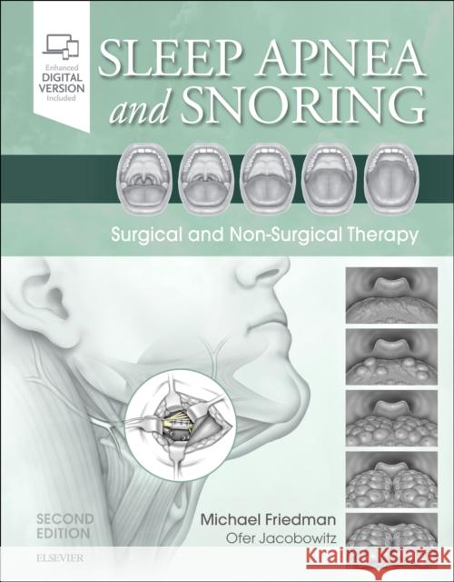 Sleep Apnea and Snoring: Surgical and Non-Surgical Therapy Friedman, Michael 9780323443395