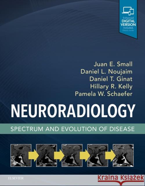 Neuroradiology: Spectrum and Evolution of Disease Juan Small Daniel Noujaim Daniel Thomas Ginat 9780323445498