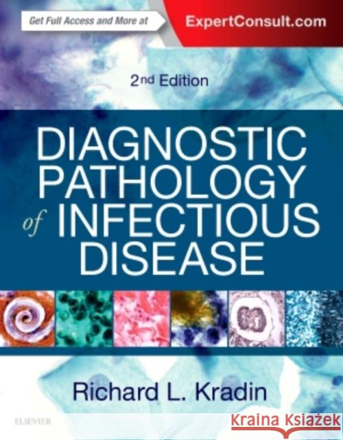 Diagnostic Pathology of Infectious Disease Richard L. Kradin 9780323445856 Elsevier