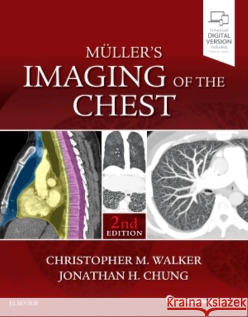 Muller's Imaging of the Chest: Expert Radiology Series Walker, Christopher 9780323462259