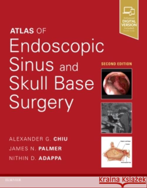 Atlas of Endoscopic Sinus and Skull Base Surgery Adappa, Nithin D. 9780323476645 Elsevier
