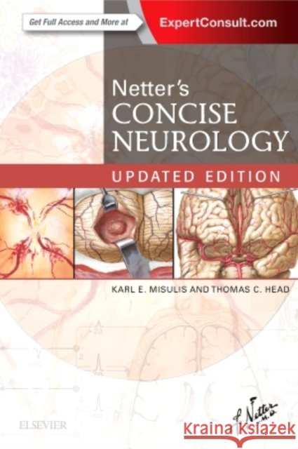 Netter's Concise Neurology Updated Edition Karl E. Misulis Thomas C. Head  9780323482547