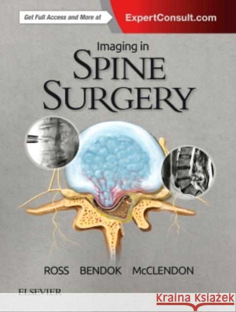 Imaging in Spine Surgery Jeffrey S. Ross Bernard R. Bendock Jamal McClendo 9780323485548