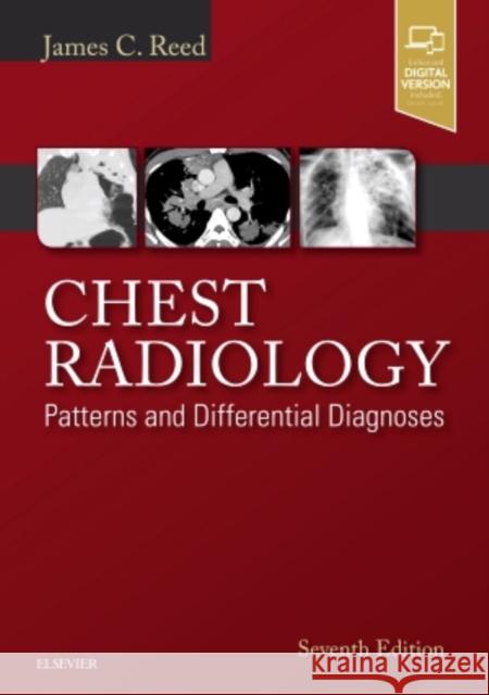Chest Radiology: Patterns and Differential Diagnoses Reed   9780323498319 Elsevier - Health Sciences Division