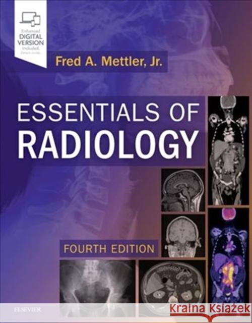 Essentials of Radiology: Common Indications and Interpretation Fred A., Jr. (Emeritus Professor, Department of Radiology, University of New Mexico, School of Medicine, Health Sciences 9780323508872