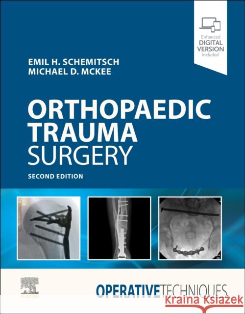 Operative Techniques: Orthopaedic Trauma Surgery Emil Schemitsch Michael D. McKee  9780323508889