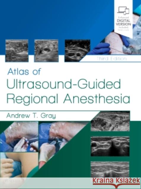 Atlas of Ultrasound-Guided Regional Anesthesia Gray, Andrew T. 9780323509510 Elsevier - Health Sciences Division