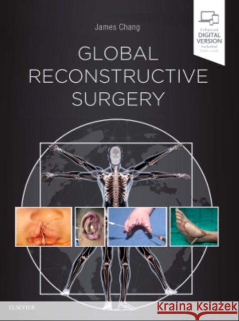 Global Reconstructive Surgery James Chang, MD, Dr.   9780323523776