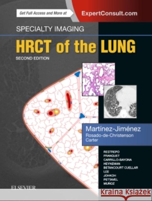 Specialty Imaging: Hrct of the Lung Martínez-Jiménez, Santiago 9780323524773