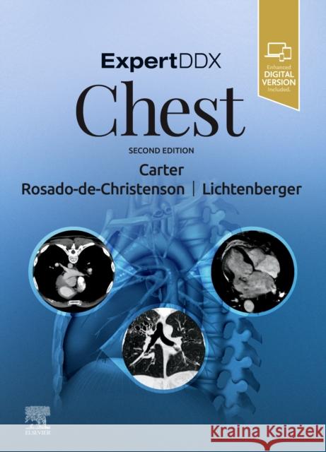 Expertddx: Chest Brett W. Carter Melissa L. Rosado-De-Christenson John P. Lichtenberge 9780323524827