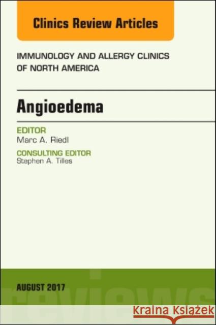 Angioedema, an Issue of Immunology and Allergy Clinics of North America: Volume 37-3 Riedl, Marc 9780323532372 Elsevier