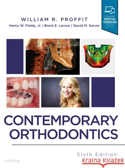 Contemporary Orthodontics William R. Proffit Henry W. Fields Brent Larson 9780323543873 Elsevier - Health Sciences Division