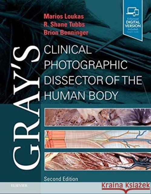 Gray's Clinical Photographic Dissector of the Human Body Marios Loukas Brion Benninger R. Shane Tubbs 9780323544177 Elsevier - Health Sciences Division