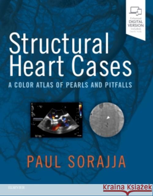 Structural Heart Cases: A Color Atlas of Pearls and Pitfalls Sorajja, Paul 9780323546959 Elsevier - Health Sciences Division