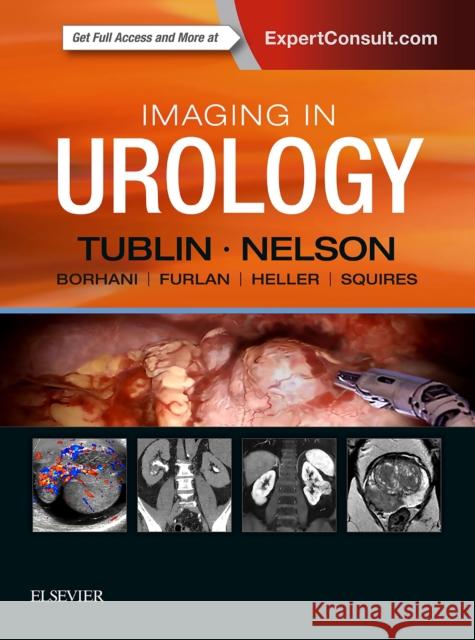 Imaging in Urology Mitchell E. Tublin Joel B. Nelson 9780323548090