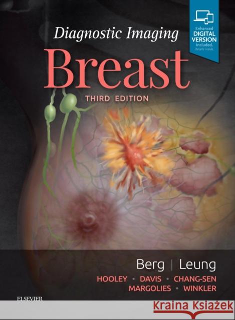 Diagnostic Imaging: Breast Wendie A. Berg Jessica Leung  9780323548120 Elsevier - Health Sciences Division