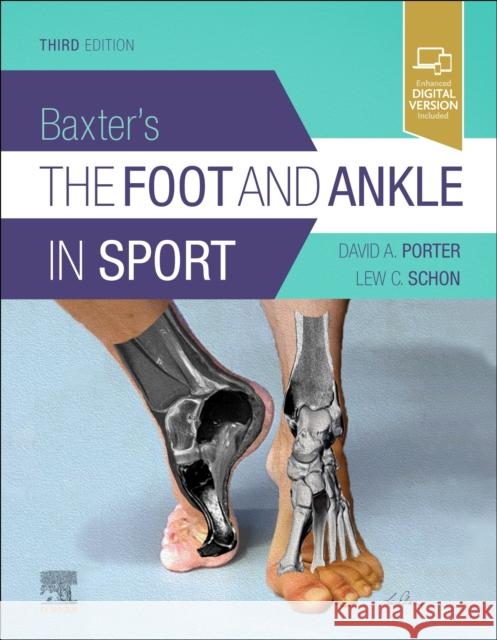 Baxter's the Foot and Ankle in Sport Porter, David A. 9780323549424 Elsevier - Health Sciences Division