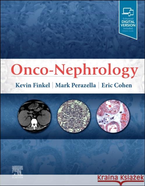Onco-Nephrology Kevin W. Finkel Mark Anthony Perazella, MD Eric P Cohen, MD 9780323549455 Elsevier - Health Sciences Division