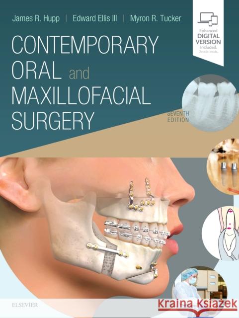 Contemporary Oral and Maxillofacial Surgery James R. Hupp Myron R. Tucker Edward Ellis 9780323552219 Mosby