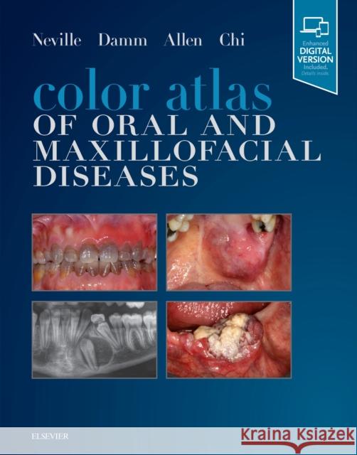 Color Atlas of Oral and Maxillofacial Diseases Neville, Brad W. 9780323552257 Elsevier