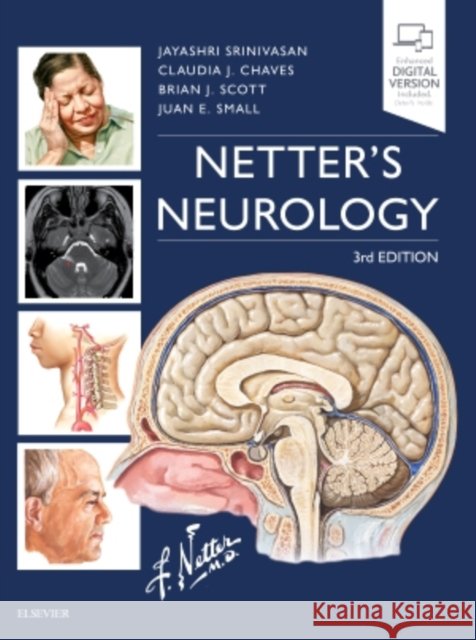 Netter's Neurology Jayashri Srinivasan Claudia Chaves Brian Scott 9780323554763 Elsevier