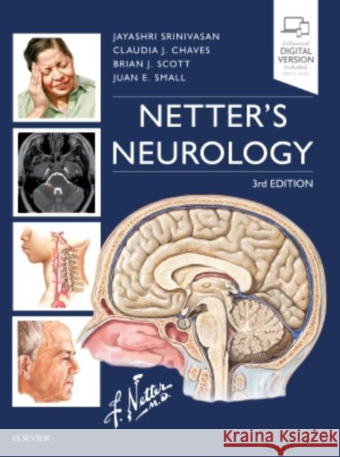 Netter's Neurology Jayashri Srinivasan Claudia Chaves Brian Scott 9780323554763