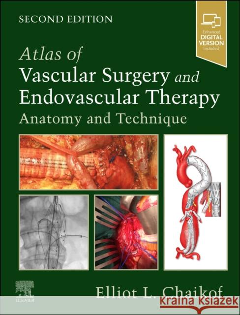 Atlas of Vascular Surgery and Endovascular Therapy: Anatomy and Technique Elliot L. Chaikof 9780323566940 Elsevier - Health Sciences Division