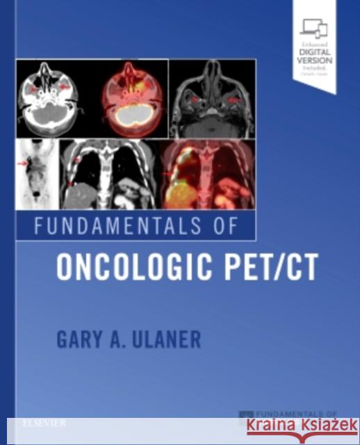 Fundamentals of Oncologic Pet/CT Gary A. Ulaner 9780323568692 Elsevier