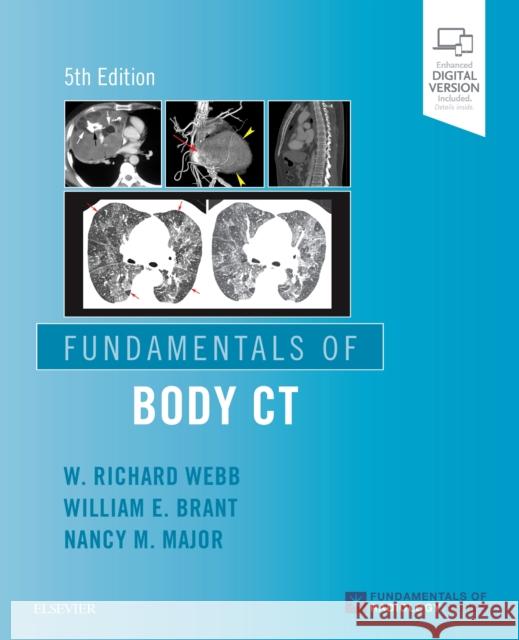 Fundamentals of Body CT W. Richard Webb Wiliam E. Brant Nancy M. Major 9780323608329