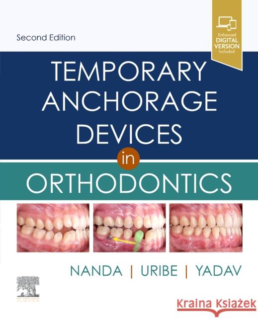 Temporary Anchorage Devices in Orthodontics Ravindra Nanda Flavio Andres Uribe Sumit Yadav 9780323609333 Elsevier