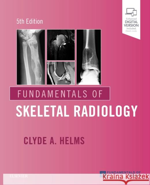 Fundamentals of Skeletal Radiology Clyde A. Helms   9780323611657