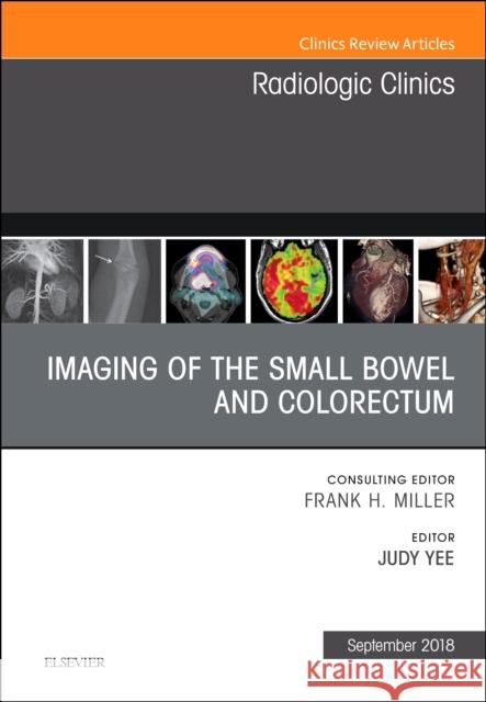 Imaging of the Small Bowel and Colorectum, an Issue of Radiologic Clinics of North America: Volume 56-5 Yee, Judy 9780323614108