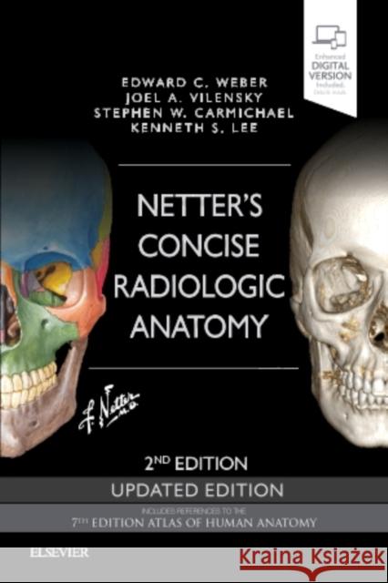 Netter's Concise Radiologic Anatomy Updated Edition Edward C. Weber, D.O (Radiologist the Im Joel A. Vilensky (Professor of Anatomy a Stephen W. Carmichael, PhD (Professor  9780323625326