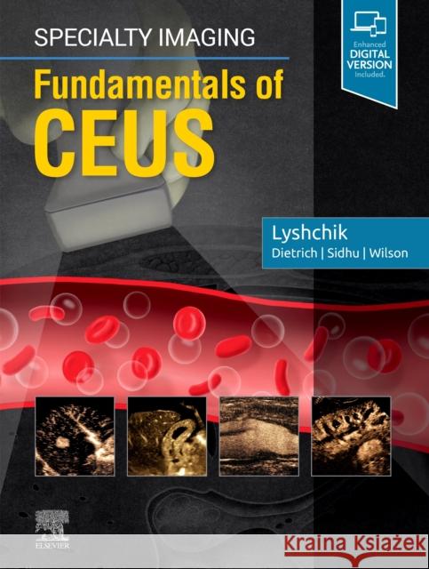 Specialty Imaging: Fundamentals of CEUS Andrej, MD, PhD (Associate Professor of Radiology, Thomas Jefferson University Hospital, Philadelphia, Pennsylvania) Lys 9780323625647 Elsevier - Health Sciences Division