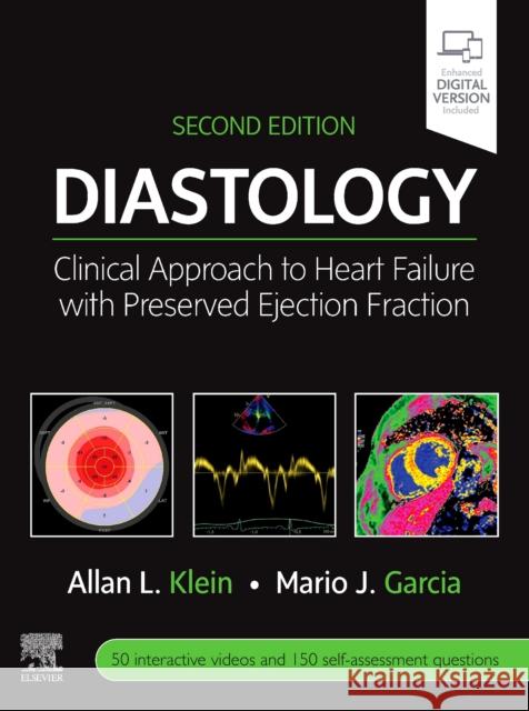 Diastology: Clinical Approach to Heart Failure with Preserved Ejection Fraction Allan L. Klein Mario J. Garcia 9780323640671 Elsevier