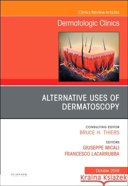 Alternative Uses of Dermatoscopy, an Issue of Dermatologic Clinics: Volume 36-4 Micali, Giuseppe 9780323641234