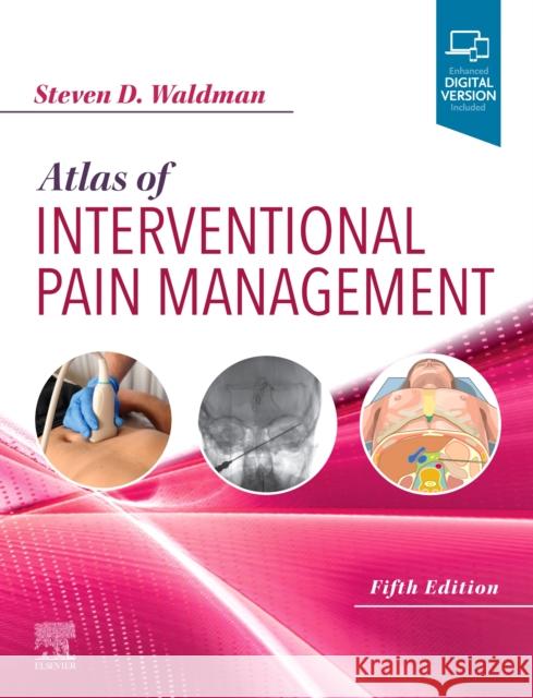 Atlas of Interventional Pain Management Steven D. Waldman 9780323654074