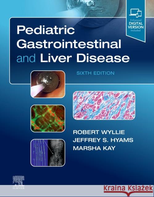 Pediatric Gastrointestinal and Liver Disease Robert Wyllie Jeffrey S. Hyams Marsha Kay 9780323672931 Elsevier