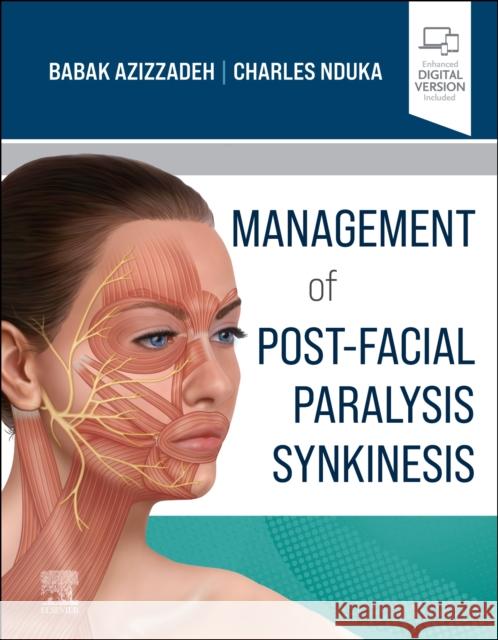 Management of Post-Facial Paralysis Synkinesis Babak Azizzadeh Charles Nduka 9780323673310 Elsevier - Health Sciences Division