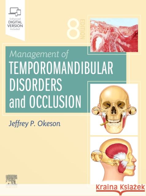 Management of Temporomandibular Disorders and Occlusion Jeffrey P. Okeson   9780323676748 Elsevier - Health Sciences Division