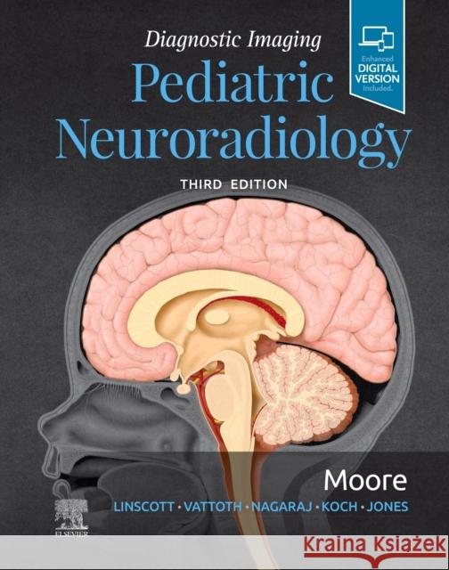 Diagnostic Imaging: Pediatric Neuroradiology Kevin R. Moore   9780323680318 Amirsys, Inc