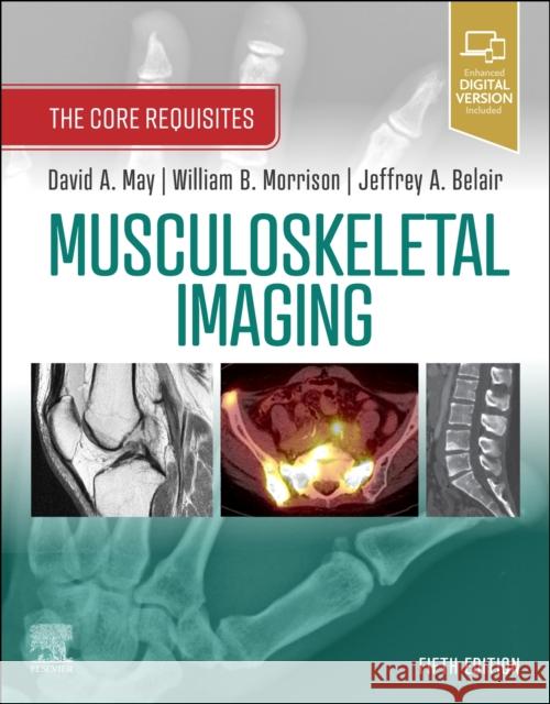 Musculoskeletal Imaging: The Core Requisites David A. May William B. Morrison Jeffrey A. Belair 9780323680592 Elsevier - Health Sciences Division