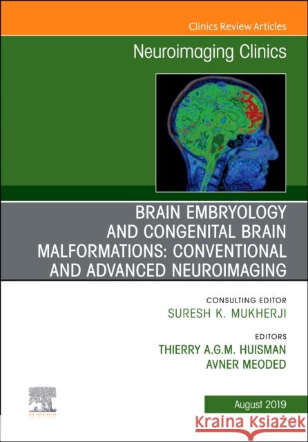Brain Embryology and the Cause of Congenital Malformations, an Issue of Neuroimaging Clinics of North America: Volume 29-3 Huisman, Thierry A. G. M. 9780323682466