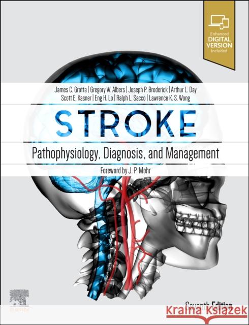 Stroke: Pathophysiology, Diagnosis, and Management James C. Grotta Gregory W. Albers Joseph P. Broderick 9780323694247