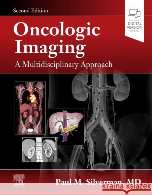 Oncologic Imaging: A Multidisciplinary Approach Silverman, Paul M. 9780323695381