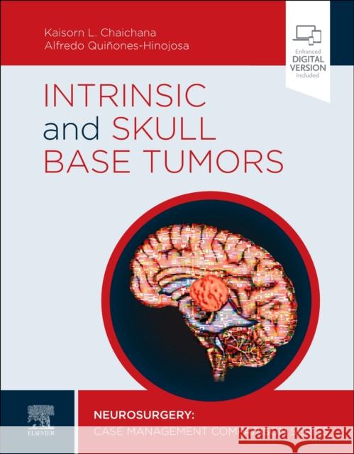 Intrinsic and Skull Base Tumors: Neurosurgery: Case Management Comparison Series Chaichana, Kaisorn 9780323696425