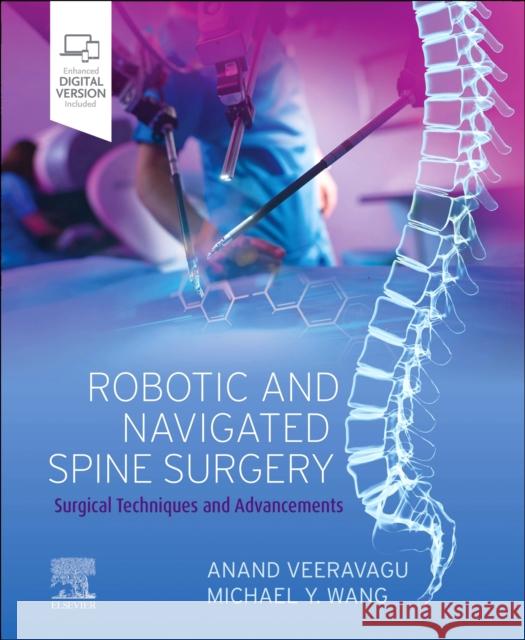 Robotic and Navigated Spine Surgery: Surgical Techniques and Advancements Anand Veeravagu Michael Wang 9780323711609 Elsevier - Health Sciences Division