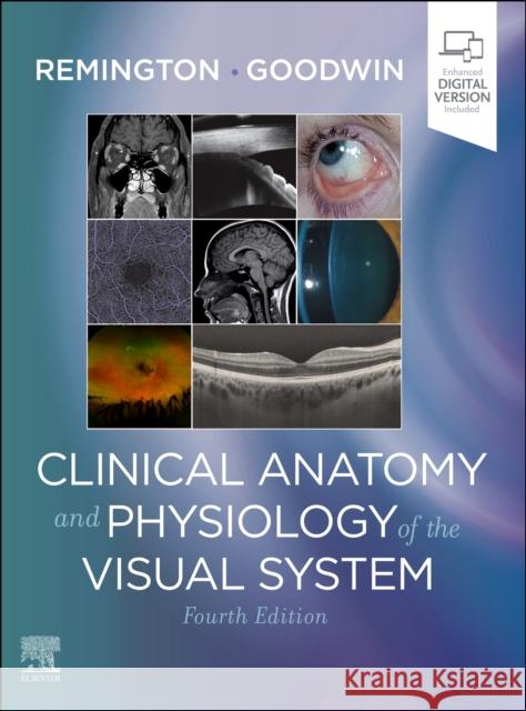 Clinical Anatomy and Physiology of the Visual System Lee Ann Remington Denise Goodwin 9780323711685 Elsevier