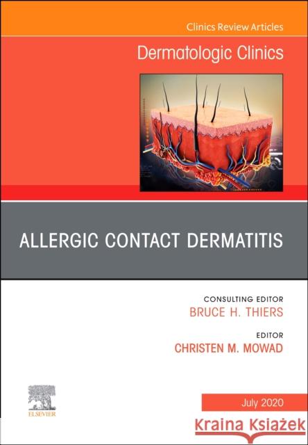 Allergic Contact Dermatitis, an Issue of Dermatologic Clinics Christen M. Mowad 9780323712132 Elsevier