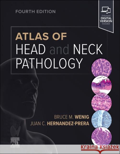 Atlas of Head and Neck Pathology Bruce M. Wenig Juan C. Hernandez-Prera 9780323712576 Elsevier - Health Sciences Division